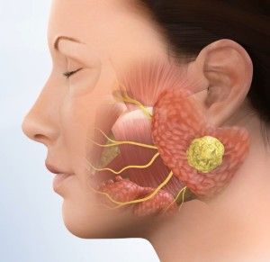 Salivary Gland Surgery